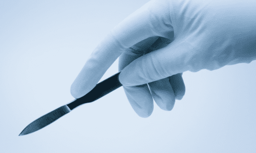 a hand in a glove holding a scalpel