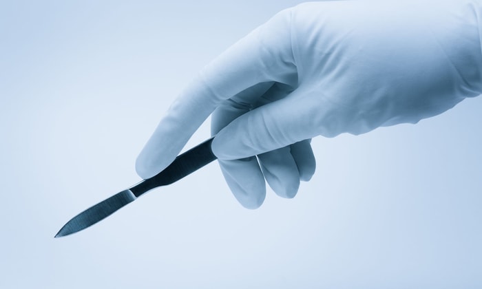 a hand in a glove holding a scalpel